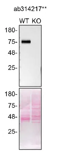 Western blot - Human SCARB2 knockout MCF7 cell line (AB274952)