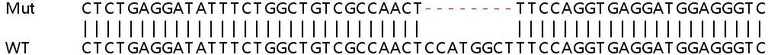 Sanger Sequencing - Human SCD5 knockout HeLa cell lysate (AB258650)