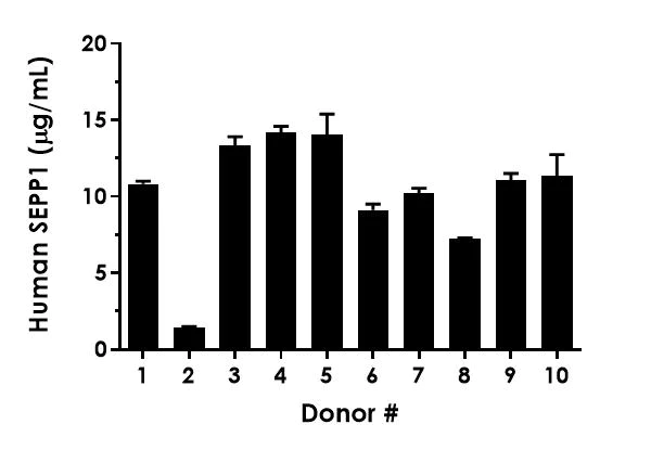 Sandwich ELISA - Human SEPP1 ELISA Kit (AB303751)