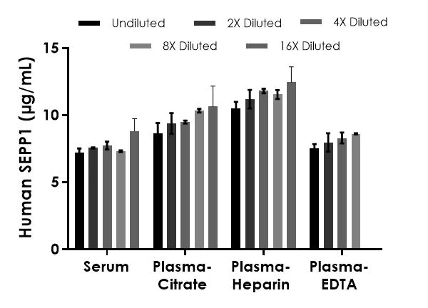 Sandwich ELISA - Human SEPP1 ELISA Kit (AB303751)