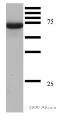 Western blot - Anti-Human Serum Albumin antibody [15C7] (AB10241)