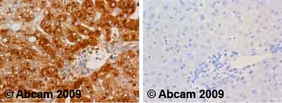 Immunohistochemistry (Formalin/PFA-fixed paraffin-embedded sections) - Anti-Human Serum Albumin antibody (AB2406), expandable thumbnail