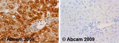Immunohistochemistry (Formalin/PFA-fixed paraffin-embedded sections) - Anti-Human Serum Albumin antibody (AB2406)