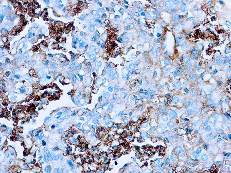 Immunohistochemistry (Formalin/PFA-fixed paraffin-embedded sections) - Anti-Human Serum Albumin antibody (AB2406), expandable thumbnail