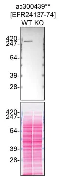 Western blot - Human SETX knockout RKO cell line (AB324539)
