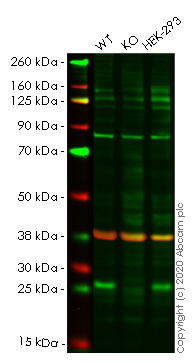 Human SIKE1 knockout HeLa cell line