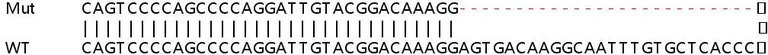 Sanger Sequencing - Human SIPA1 (Spa-1) knockout HeLa cell line (AB265434)
