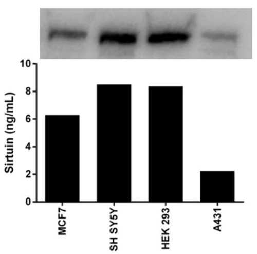 ELISA - Human SIRT1 ELISA Kit (AB171573)