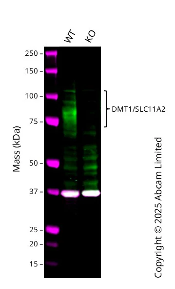 Western blot - Human SLC11A2 knockout A549 cell line (AB326025)