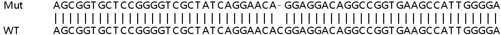 Human SLC22A5 (Solute carrier family 22 member 5) knockout HeLa cell lysate