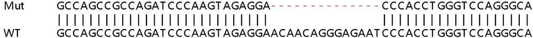 Sanger Sequencing - Human SLC27A4 (FATP4) knockout HEK-293T cell line (AB266114)