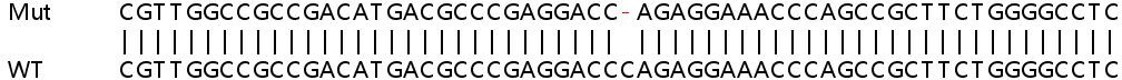 Sanger Sequencing - Human SLC2A8 (Glucose Transporter 8) knockout HeLa cell line (AB265674)