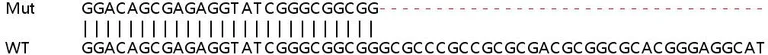 Sanger Sequencing - Human SLC44A1 (CTL1) knockout HeLa cell line (AB265357)