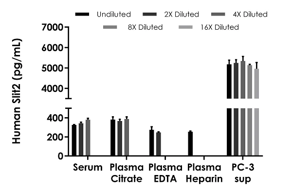 Human Slit2 ELISA Kit, colorimetric, 90-min ELISA (ab283885) | Abcam