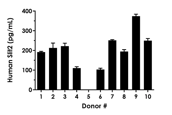 Sandwich ELISA - Human Slit2 ELISA Kit (AB283885)