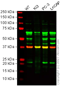 Western blot - Human SLPI knockout HeLa cell line (AB265215)