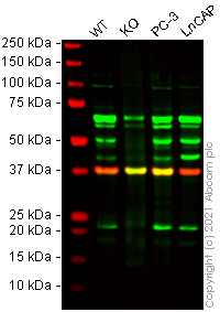 Western blot - Human SLPI knockout HeLa cell lysate (AB257685)