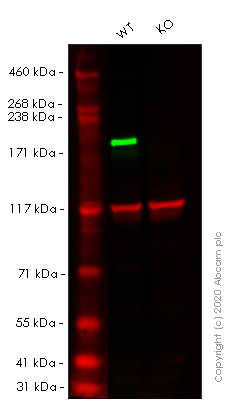Western blot - Human SMARCA4 (BRG1) knockout HEK-293T cell lysate (AB263853), expandable thumbnail