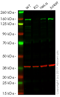 Western blot - Human SMARCC1 (BAF155) knockout HEK-293 cell line (AB261854), expandable thumbnail