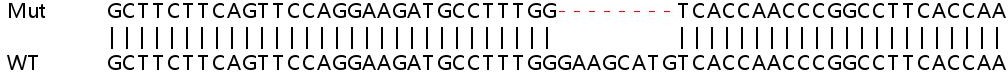 Sanger Sequencing - Human SMARCC1 (BAF155) knockout HeLa cell lysate (AB258198), expandable thumbnail
