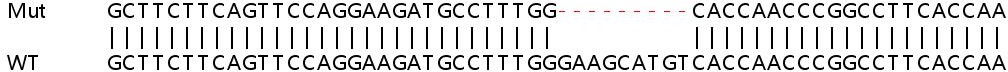 Sanger Sequencing - Human SMARCC1 (BAF155) knockout HeLa cell lysate (AB258198), expandable thumbnail