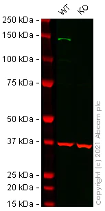 Western blot - Human SMARCC1 (BAF155) knockout HeLa cell lysate (AB258198)