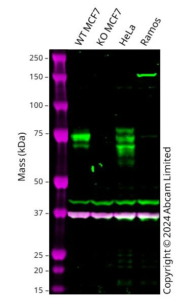 Western blot - Human SMPD1 knockout MCF7 cell line (AB326026)