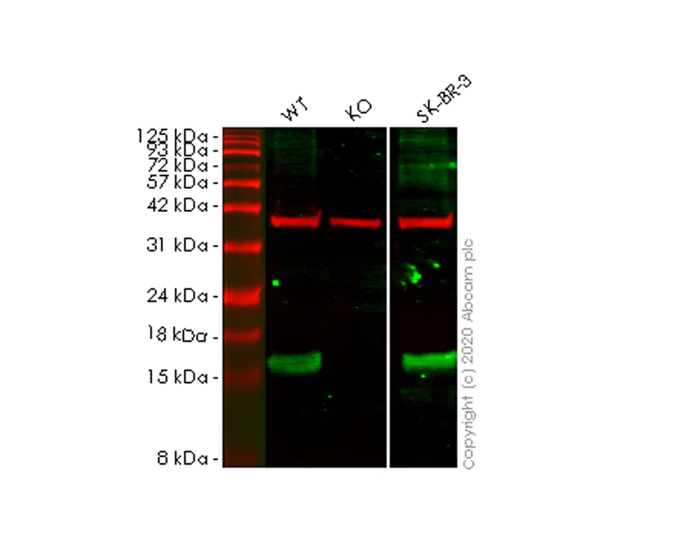 Western blot - Human SNCG (gamma Synuclein) knockout HeLa cell line (AB265623)
