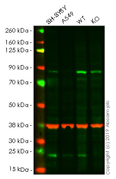 Western blot - Human SOD2 (MnSOD) knockout HEK-293T cell line (AB255434)