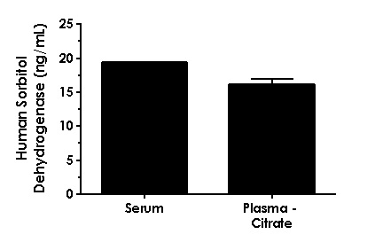 Sandwich ELISA - Human Sorbitol Dehydrogenase ELISA Kit (AB233613)