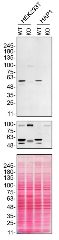 Western blot - Human SPAST (Spastin) knockout HEK-293T cell lysate (AB258698)