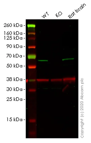 Western blot - Human SPAST (Spastin) knockout HEK-293T cell lysate (AB258698)