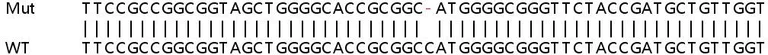 Sanger Sequencing - Human SPG11 knockout HeLa cell line (AB265402)