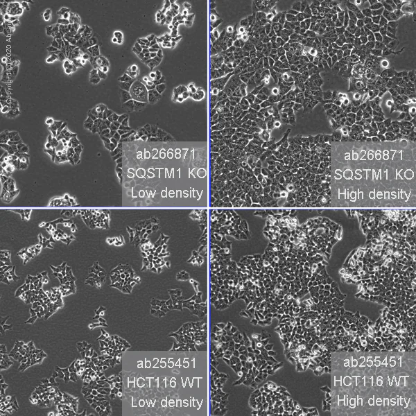 Cell Culture - Human SQSTM1 (p62) knockout HCT116 cell line (AB266871)