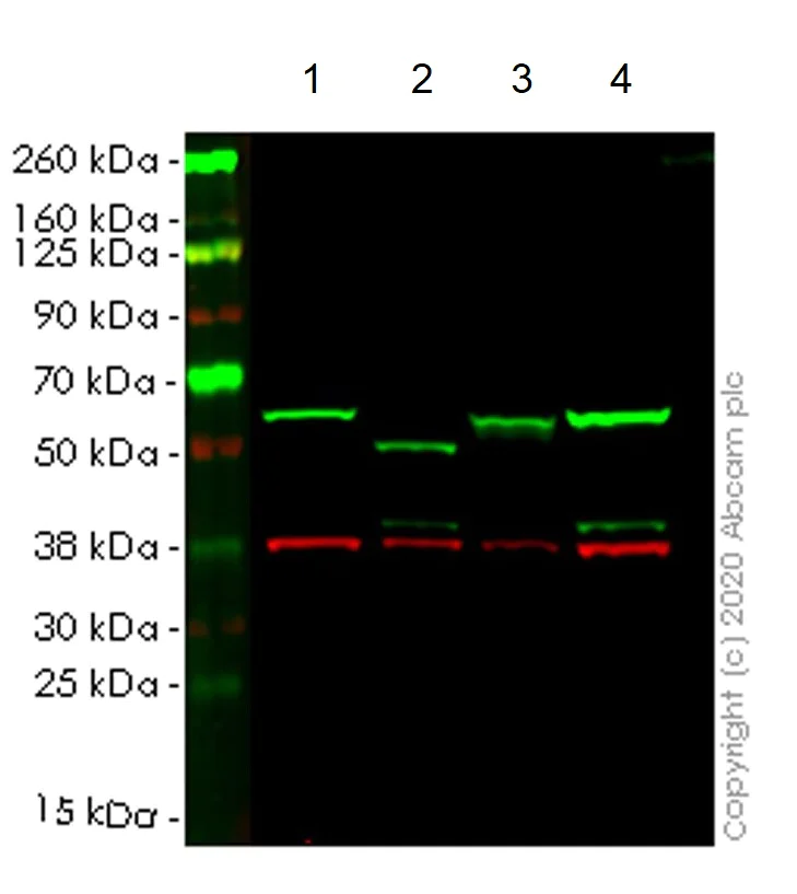Western blot - Human SQSTM1 (p62) knockout HCT116 cell line (AB266871)