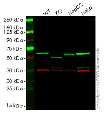Western blot - Human SQSTM1 (p62) knockout HCT116 cell lysate (AB257052)