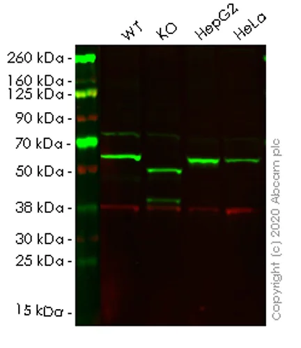 Western blot - Human SQSTM1 (p62) knockout HCT116 cell lysate (AB257052)