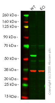 Western blot - Human SQSTM1 (p62) knockout HEK-293T cell line (AB255343), expandable thumbnail