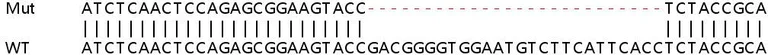 Sanger Sequencing - Human STAMBP (AMSH) knockout HeLa cell line (AB265249)