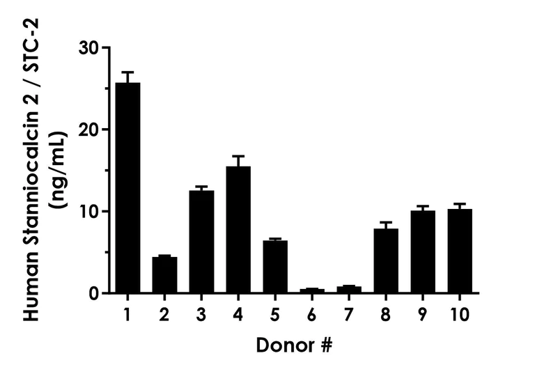 Sandwich ELISA - Human Stanniocalcin 2 / STC-2 ELISA Kit- Extracellular (AB320044)
