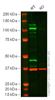 Western blot - Human STAT2 knockout HeLa cell lysate (AB257182)