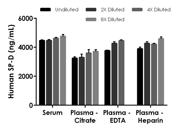 Sandwich ELISA - Human Surfactant protein D / SP-D ELISA Kit (AB239431), expandable thumbnail
