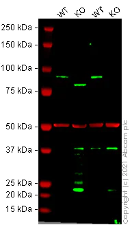 Western blot - Human SUZ12 knockout HeLa cell line (AB264983)