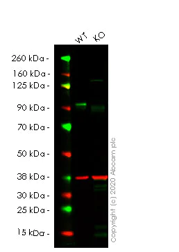 Western blot - Human SUZ12 knockout HeLa cell lysate (AB257721)