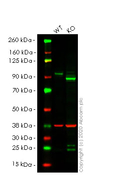 Western blot - Human SUZ12 knockout HeLa cell lysate (AB257721)
