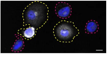 Immunocytochemistry/ Immunofluorescence - Human SYK knockout THP-1 cell line (AB288700)