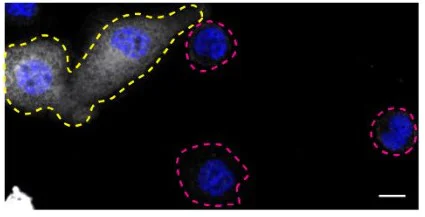 Immunocytochemistry/ Immunofluorescence - Human SYK knockout THP-1 cell line (AB288700)
