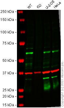 Western blot - Human TAB1 knockout HEK-293T cell line (AB266845)