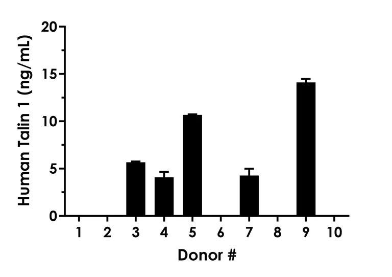 Sandwich ELISA - Human Talin 1 ELISA Kit- extracellular (AB315317)
