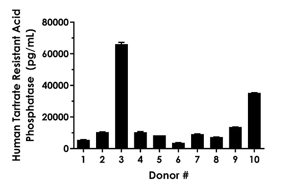 Sandwich ELISA - Human Tartrate Resistant Acid Phosphatase ELISA Kit (ACP5) (AB282307)